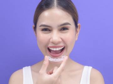 How To Choose The Best Invisalign Provider In Spring, TX